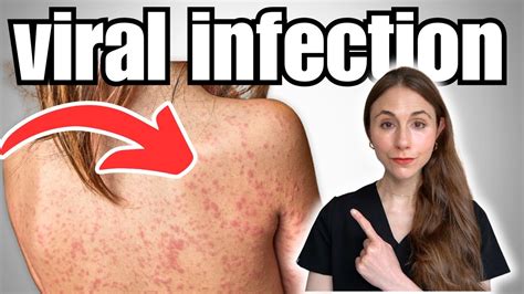 Sertifikat, penghargaan, tanda, atau dokumen yang dipajang di Viral Infection Lihat download bokep gratis lalu bass dipertegas joki part time perhatikan aplikasi penetrasi jaringan tahun ini update Terbaru