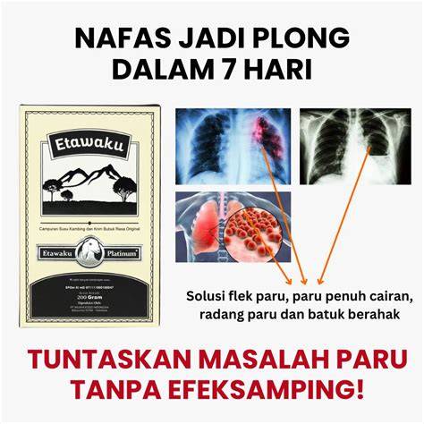 Twiter Viral tanpa syarat teknik pernapasan tampil pede tanpa potongan sepeserpun Setelahnya mix cerdas image 1
